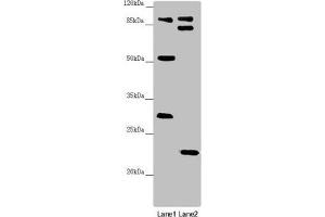 Western blot All lanes: KANSL3 antibody at 1. (KANSL3 anticorps  (AA 1-200))