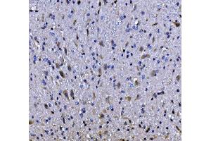 IHC analysis of EEF2/Elongation factor 2 using anti-EEF2/Elongation factor 2 antibody (ABIN7603142). (EEF2 anticorps  (N-Term))