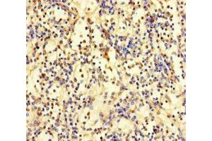 Immunohistochemistry of paraffin-embedded human spleen tissue using ABIN7176159 at dilution of 1:100 (ZNF221 anticorps  (AA 1-300))
