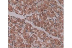 DAB staining on IHC-P Samples:Human Stomach Tissue. (ENPP2 anticorps  (AA 637-905))