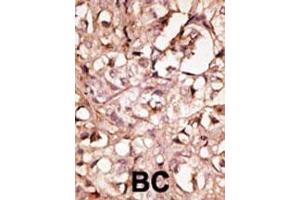 anti-Lymphatic Vessel Endothelial Hyaluronan Receptor 1 (LYVE1) (AA 46-77), (N-Term) antibody