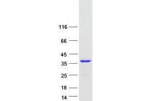 Validation with Western Blot