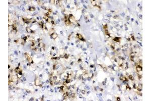 IHC analysis of CA2 using anti- CA2 antibody .
