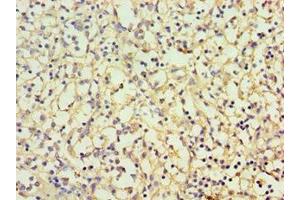 Immunohistochemistry of paraffin-embedded human spleen tissue using ABIN7146745 at dilution of 1:100