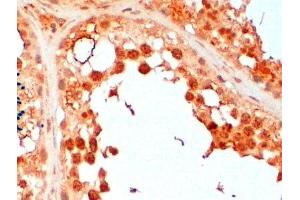 ABIN2560635 (2µg/ml) staining of paraffin embedded Human Testis. (UBE2R2 anticorps  (N-Term))