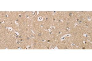 Immunohistochemistry of paraffin-embedded Human brain tissue using P2RY11 Polyclonal Antibody at dilution of 1:30(x200) (P2RY11 anticorps)
