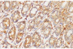 Immunohistochemistry of paraffin-embedded Rat colon using HRAS Polycloanl Antibody at dilution of 1:200 (HRAS anticorps)
