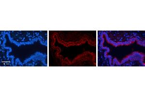 TKT antibody - N-terminal region          Formalin Fixed Paraffin Embedded Tissue:  Human Bronchial Epithelial Tissue    Observed Staining:  Cytoplasm of bronchial epithelial tissue   Primary Antibody Concentration:  1:100    Secondary Antibody:  Donkey anti-Rabbit-Cy3    Secondary Antibody Concentration:  1:200    Magnification:  20X    Exposure Time:  0. (TKT anticorps  (N-Term))