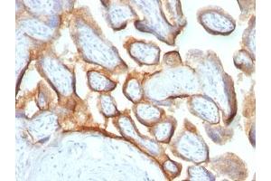 Formalin-fixed, paraffin-embedded human placenta stained with hCG beta antibody (HCGb/54 + HCGb/459). (HCG beta anticorps)