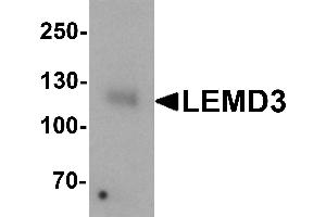 Western blot analysis of LEMD3 in human colon tissue lysate with LEMD3 antibody at 1 µg/mL.