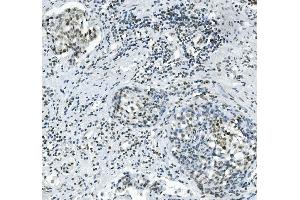 IHC analysis of PRDM5 using anti-PRDM5 antibody (ABIN7600853). (PRDM5 anticorps  (AA 24-630))