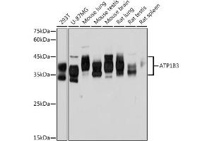 Western blot analysis of extracts of various cell lines, using B3 Rabbit mAb (ABIN7265774) at 1:1000 dilution. (ATP1B3 anticorps)