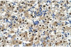 Immunohistochemical staining (Formalin-fixed paraffin-embedded sections) of human liver with GDE1 polyclonal antibody  at 4-8 ug/mL working concentration. (GDE1 anticorps  (N-Term))
