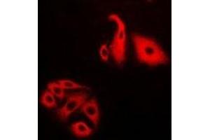 Immunofluorescent analysis of NFS1 staining in Hela cells. (NFS1 anticorps)