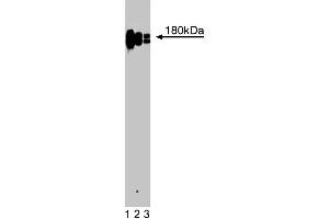 Western blot analysis of CD11a (Integrin alphaL) on a Jurkat cell lysate (Human T-cell leukemia, ATCC TIB-152). (ITGAL anticorps  (AA 64-199))
