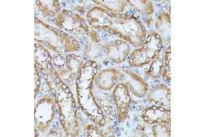 Immunohistochemistry of paraffin-embedded rat kidney using HAL antibody (ABIN6130467, ABIN6141593, ABIN6141594 and ABIN6216851) at dilution of 1:100 (40x lens). (HAL anticorps  (AA 1-200))
