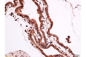 Formalin-fixed and paraffin embedded rat placenta labeled with Anti-FOXF1 Polyclonal Antibody, Unconjugated  at 1:200 followed by conjugation to the secondary antibody and DAB staining.