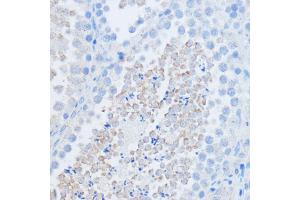 Immunohistochemistry of paraffin-embedded mouse testis using RALGDS antibody (ABIN7269838) at dilution of 1:100 (40x lens). (RALGDS anticorps)