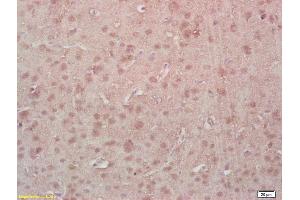 Formalin-fixed and paraffin embedded rat brain labeled with Rabbit Anti Phospho-MEF2A (Thr312) Polyclonal Antibody, Unconjugated (ABIN743768) at 1:200 followed by conjugation to the secondary antibody and DAB staining (MEF2A anticorps  (pThr312))