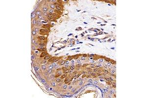 (ABIN6242624 and ABIN6577142) staining S100A2 in human skin tissue sections by Immunohistochemistry (IHC-P - paraformaldehyde-fixed, paraffin-embedded sections). (S100A2 anticorps)