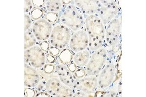 Immunohistochemistry of paraffin-embedded rat kidney using Pan-Akt Rabbit pAb (ABIN7265520) at dilution of 1:100 (40x lens). (AKT 1/2/3 anticorps)