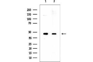 anti-Carbohydrate (N-Acetylglucosamine 6-O) Sulfotransferase 5 (CHST5) (Internal Region) antibody