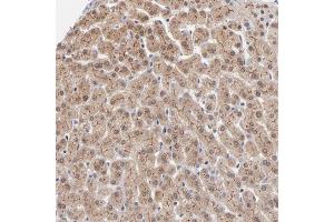 Immunohistochemical staining of human liver with WSB1 polyclonal antibody  shows cytoplasmic and membranous positivity in hepatocytes at 1:50-1:200 dilution. (WSB1 anticorps)