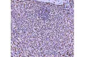 IHC analysis of FIP1L1 using anti-FIP1L1 antibody (ABIN7600761). (FIP1L1 anticorps  (AA 23-558))