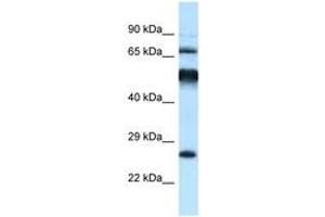 Image no. 1 for anti-Kelch-Like 1 (KLHL1) (AA 396-445) antibody (ABIN6747517) (KLHL1 anticorps  (AA 396-445))