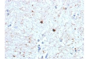 Formalin-fixed, paraffin-embedded human Brain stained with Ubiquitin-Monospecific Mouse Monoclonal Antibody (UBB/1748).