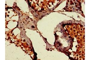Immunohistochemistry of paraffin-embedded human testis tissue using ABIN7175913 at dilution of 1:100 (PEPD anticorps  (AA 258-395))