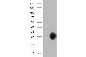 Western Blotting (WB) image for anti-Zinc Finger, AN1-Type Domain 2B (ZFAND2B) antibody (ABIN1501808) (ZFAND2B anticorps)