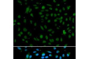 Immunofluorescence analysis of A549 cells using WHSC1L1 Polyclonal Antibody (WHSC1L1 anticorps)