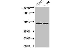 Western Blot Positive WB detected in: Mouse liver tissue, Mouse lung tissue All lanes: SEC14L3 antibody at 3 μg/mL Secondary Goat polyclonal to rabbit IgG at 1/50000 dilution Predicted band size: 47 kDa Observed band size: 47 kDa (SEC14L3 anticorps  (AA 201-400))