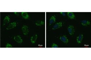 ICC/IF Image UQCRFS1 antibody [N1C3] detects UQCRFS1 protein at mitochondria by immunofluorescent analysis.