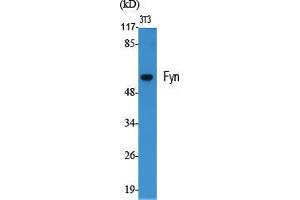 Western Blot (WB) analysis of specific cells using Fyn Polyclonal Antibody. (FYN anticorps  (Ser400))