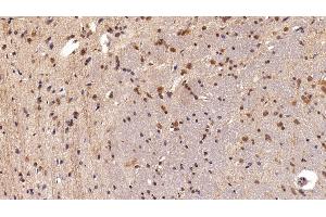 Detection of HMGB1 in Rat Cerebrum Tissue using Polyclonal Antibody to High Mobility Group Protein 1 (HMGB1) (HMGB1 anticorps  (AA 1-215))