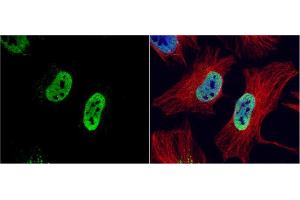 ICC/IF Image RAD21 antibody detects RAD21 protein at nucleus by immunofluorescent analysis.