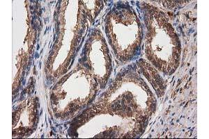 Image no. 8 for anti-Destrin (Actin Depolymerizing Factor) (DSTN) antibody (ABIN1497907)