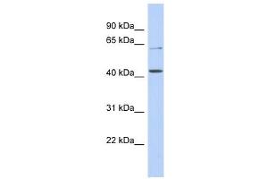 SLC22A12 antibody used at 1 ug/ml to detect target protein. (SLC22A12 anticorps)