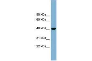 Image no. 1 for anti-PIN2/TERF1 Interacting, Telomerase Inhibitor 1 (PINX1) (AA 35-84) antibody (ABIN6744111) (PINX1 anticorps  (AA 35-84))