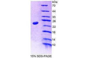 SDS-PAGE (SDS) image for Nucleoporin 35kDa (NUP35) (AA 132-310) protein (His tag) (ABIN1878350)