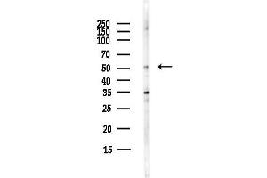 anti-Matrix Metallopeptidase 3 (Stromelysin 1, Progelatinase) (MMP3) (C-Term) antibody