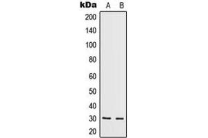 Western blot analysis of IL-5 expression in HeLa (A), HepG2 (B) whole cell lysates. (IL-5 anticorps  (Center))