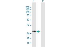 Western Blot analysis of FBXO17 expression in transfected 293T cell line by FBXO17 MaxPab polyclonal antibody. (FBXO17 anticorps  (AA 1-278))