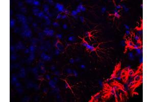Indirect immustaining of cortex section from PFA fixed mouse brain (dilution 1 : 500).