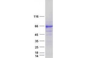 Validation with Western Blot