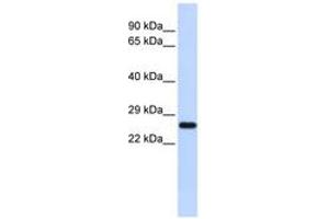 Image no. 1 for anti-Superoxide Dismutase 2, Mitochondrial (SOD2) (N-Term) antibody (ABIN6744284) (SOD2 anticorps  (N-Term))