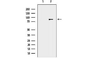 Western blot analysis of lysates from Rat heart, using DLL1-Specific Antibody.