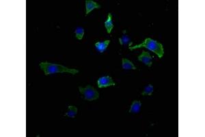 Immunofluorescence staining of SH-SY5Y cells with ABIN7167314 at 1:50, counter-stained with DAPI. (RAB39A anticorps  (AA 1-217))